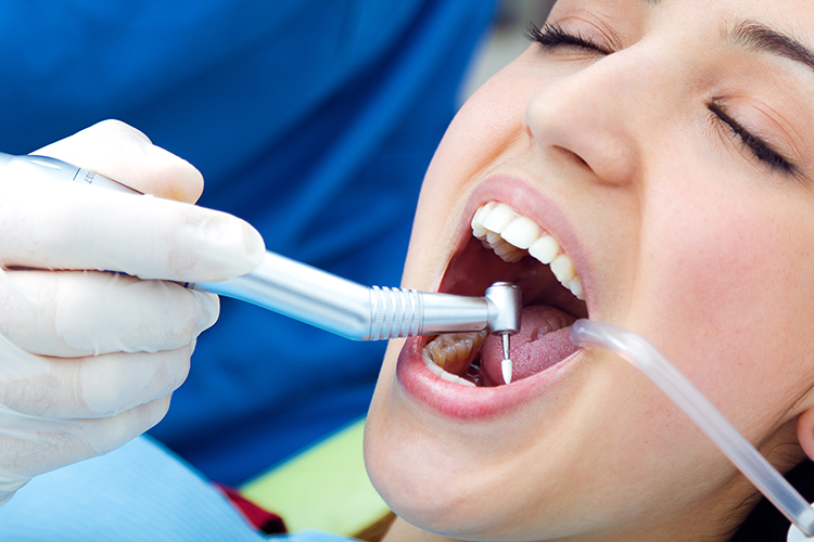 9 Lý do bạn nên đến gặp nha sĩ để khám răng thường xuyên hơn