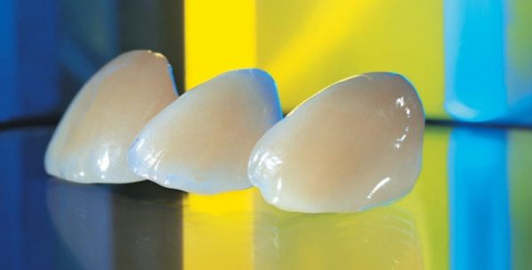 Răng sứ Emax Zirconia là gì? Ưu nhược điểm của sứ Zirconia