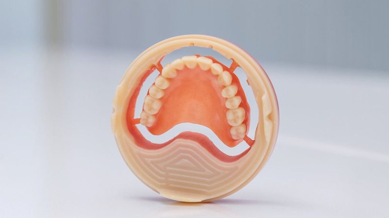 Phôi tháo lắp kỹ thuật số Ivotion – Giải pháp hỗ trợ phục hình tháo lắp toàn hàm