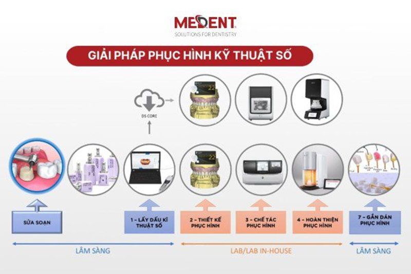 Quy tr&igrave;nh sản xuất răng sứ gồm nhiều giai đoạn phối hợp giữa ph&ograve;ng kh&aacute;m v&agrave; labo nha khoa.
