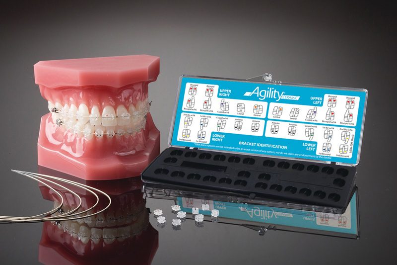 Mắc c&agrave;i sứ c&oacute; metal-slot tạo ma s&aacute;t thấp hơn mắc c&agrave;i sứ th&ocirc;ng thường, tiệm cận hiệu suất của mắc c&agrave;i kim loại.